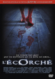 L'Ecorché