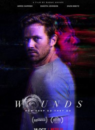 Wounds